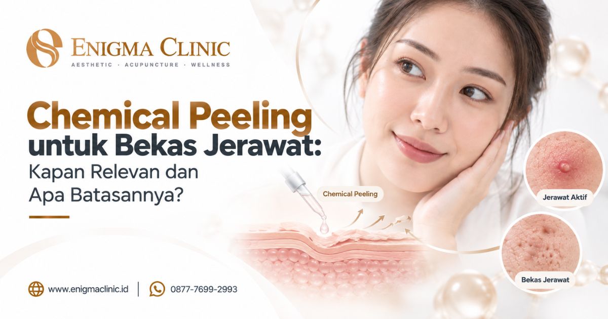 Chemical Peeling untuk Bekas Jerawat: Kapan Relevan dan Apa Batasannya?